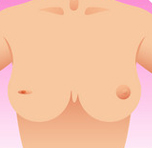 Breast Care Center in Coimbatore