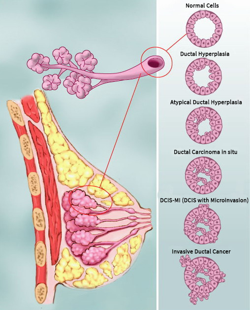 Ganga Breast Care Center in Coimbatore