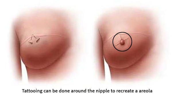 Ganga Breast Care